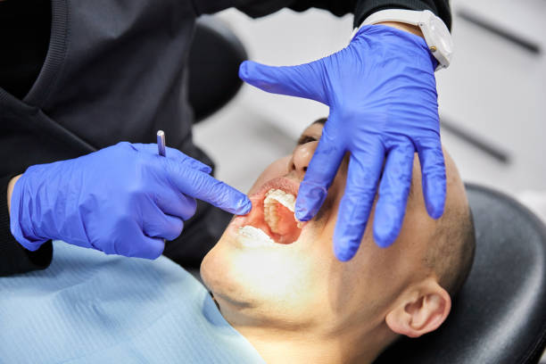 Best Emergency Wisdom Teeth Removal in East Highland Park, VA