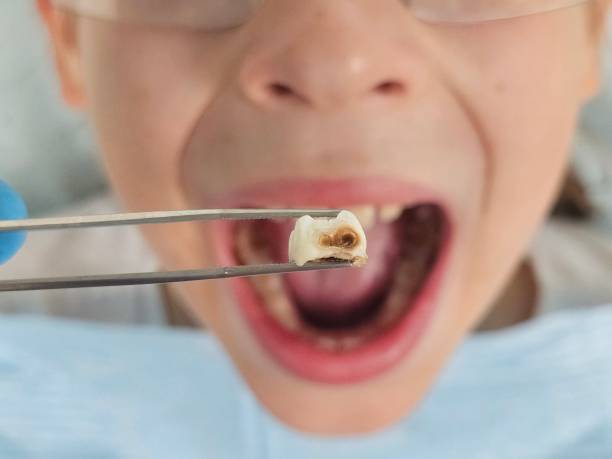 Best Emergency Dental Care for Trauma or Injury in East Highland Park, VA